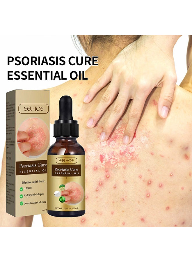 إيلهو زيت EELHOE العطري لإصلاح البشرة، يخفف من حكة الجلد وتورمه - Image 4