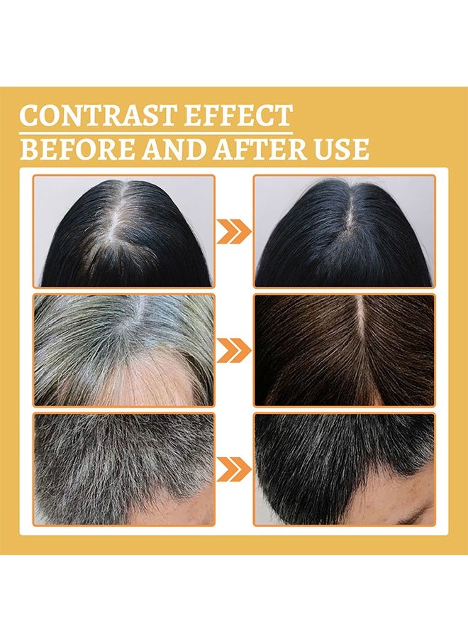 SOUTH MOON Ganoderma Nutrient Natural Darkening， Grey Hair Recoloring Damage Hair Care Activates Hair Follicles &Melanin 30ml - Image 3