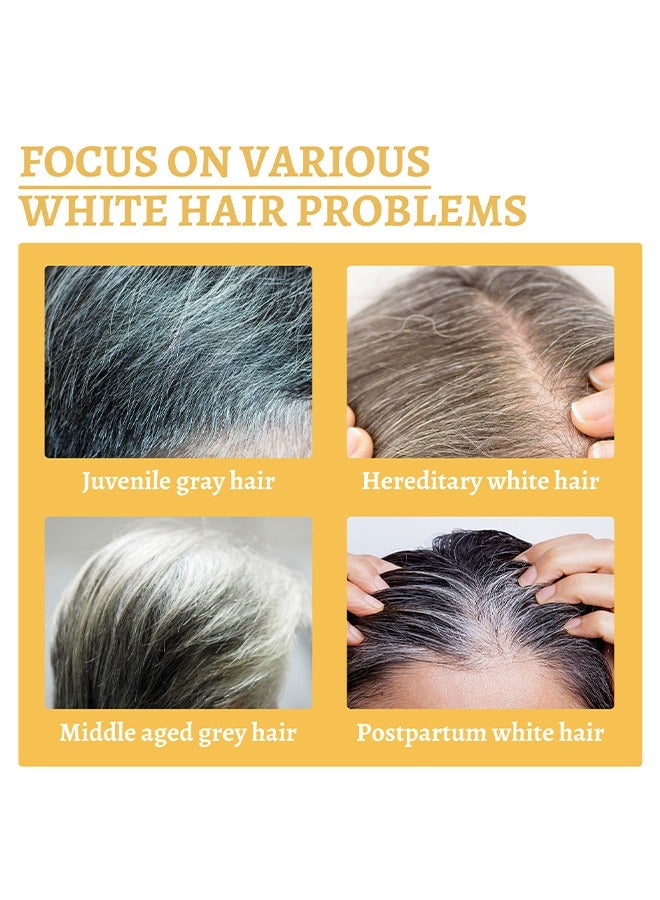 SOUTH MOON Ganoderma Nutrient Natural Darkening， Grey Hair Recoloring Damage Hair Care Activates Hair Follicles &Melanin 30ml - Image 4