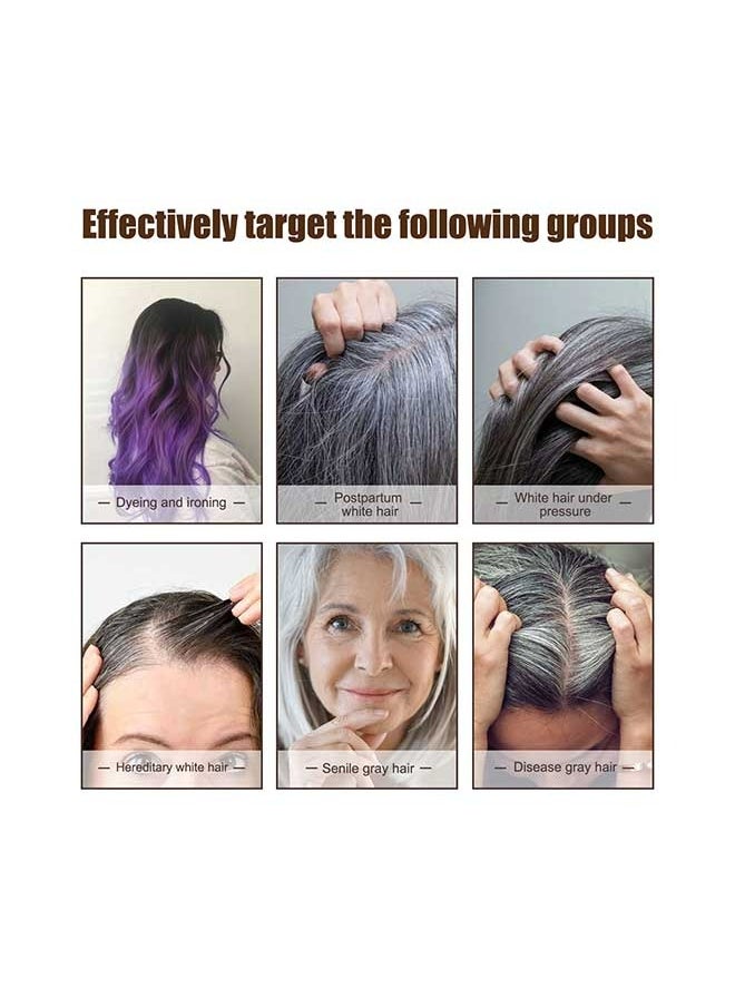 Jaysuing - Anti White Hair Essence 30ml, Dark Anti Graying Hair Serum for Men and Women, Nutrient Natural Darkening, Promoting Healthier and Thicker Hair - Image 1