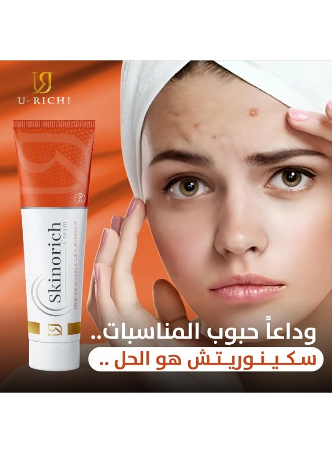 U-RICHI Skinorich Azelaic Cream for Acne, Pigmentation, and Even Skin Tone, with Azelaic Acid and Salicylic Acid, 35g - Image 3