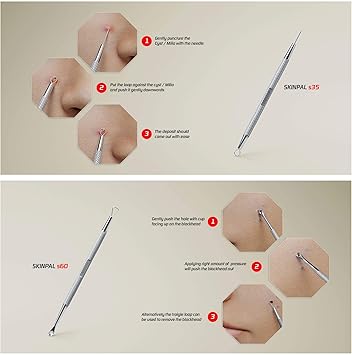 Suvorna S100 Milia Remover Tool Blackhead Remover Tool kit Whitehead Remover Comedone Extractor Black Head Remove Tool Cyst Removal kit Acne Treatment Pimple Popping kit 4 in 1 Pack - Image 2