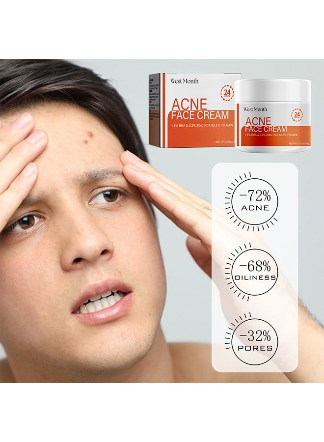 WEST MONTH Acne Face Cream, Acne Spot Treatment for Face & Acne Dots, Natural Cystic Acne Treatment, For All Skin Types, Premium Acne Scar Cream & Pimple Remover 100g - Image 5
