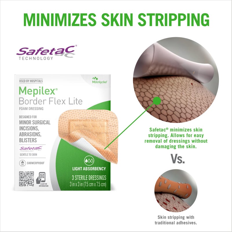 Mepilex Border Flex Lite 3 x 3 in (7.5x7.5 cm) Hospital Grade Dressings for Minor Surgical Incisions, Abrasions and Blisters for Up to Several Day Use - Image 3