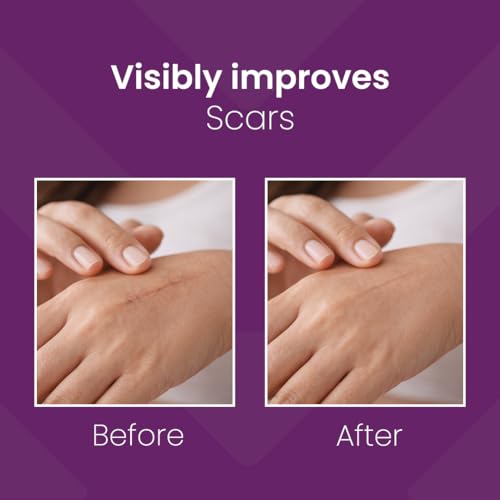Mederma جيل ميديرما المتقدم بلس لعلاج الندبات، بنفسجي، 10 جرام - Image 3
