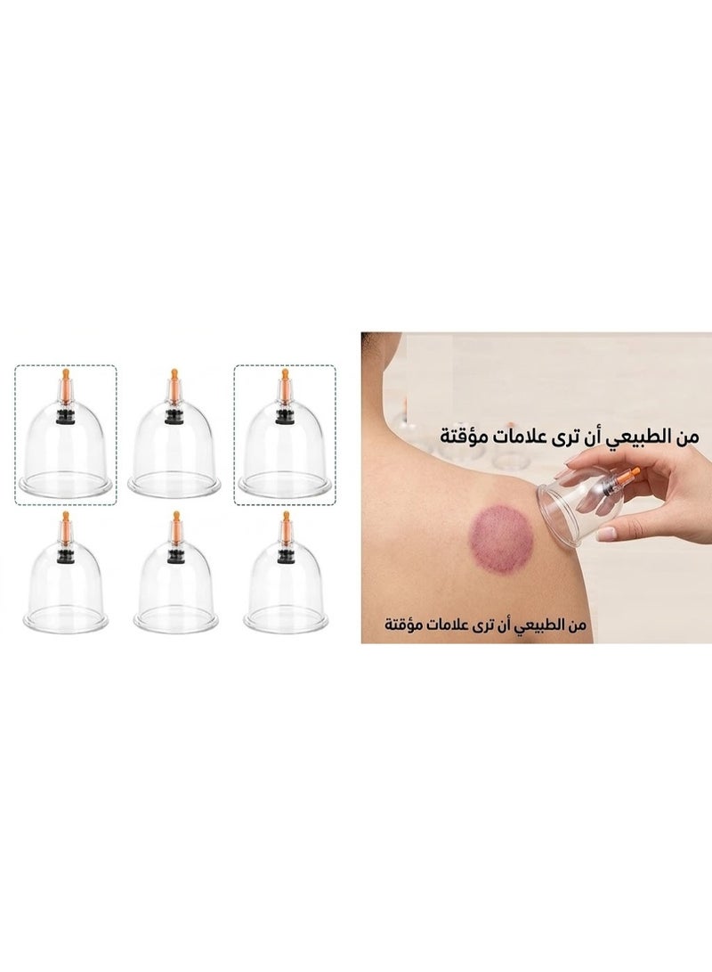 مجموعة أكواب العلاج بالحجامة الصينية التقليدية المغناطيسية الحيوية 6 كوب مجموعة الحجامة الفراغية لتخفيف الآلام - Image 2