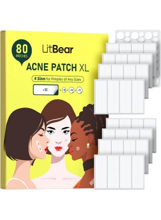 Large Pimple Patches For Face (4 Sizes 80 Patches), Big Acne Patches, Xl Hydrocolloid Bandages Strips For Body, Forehead, Cheek, Chin, Butt, Back & Chest, Rectangle Hydrocolloid Patch - pzsku/Z95F9BCF87C61FE596E87Z/45/_/1734183305/556a3080-c2ee-4d1e-960a-215cd1109dcc