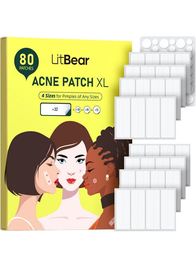 LitBear Large Pimple Patches For Face (4 Sizes 80 Patches), Big Acne Patches, Xl Hydrocolloid Bandages Strips For Body, Forehead, Cheek, Chin, Butt, Back & Chest, Rectangle Hydrocolloid Patch 