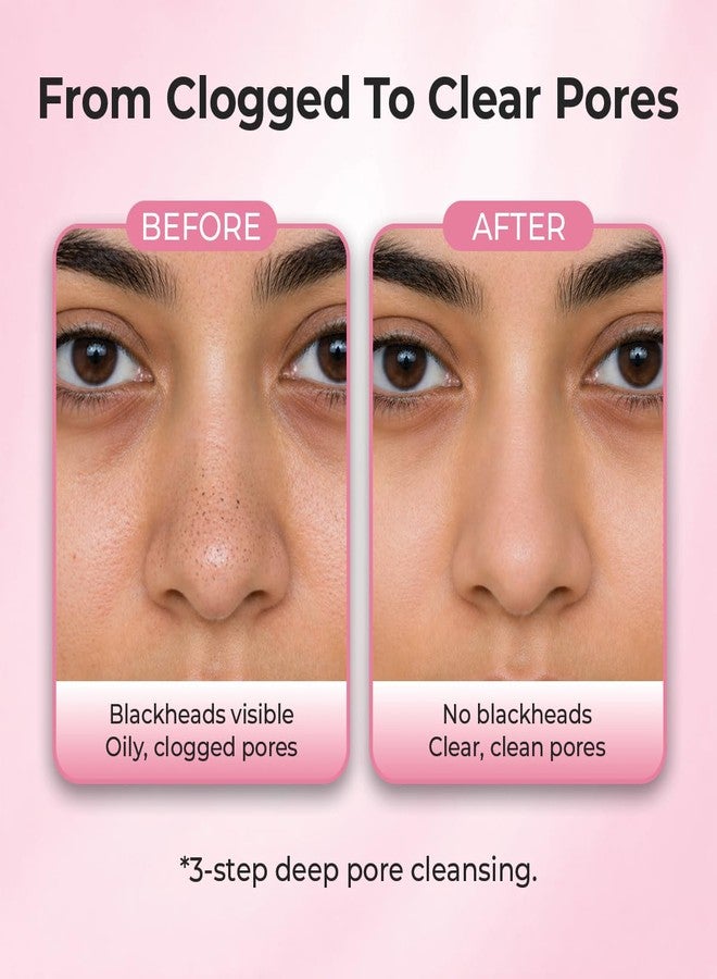 Sanfe Aloe Vera 3 Step Nose Kit | 3 Units | Nose Strips for Blackhead Removal Routine | Deep Cleansing Pore Cleaning Strips for Oily Skin Care | At Home Cleansing Kit | Peel-Off Mask Style - Image 2