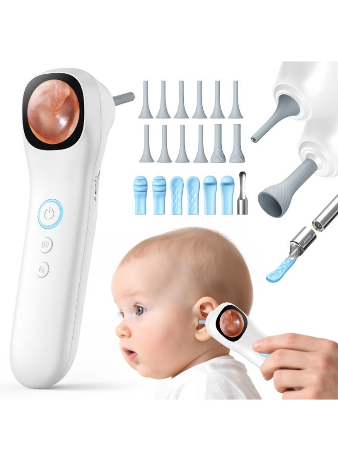 MIAOYAN 1080P Digital Ear Otoscope with 1.38-Inch LCD Screen, 4 LED Lights, 3X Magnification, 2 Interchangeable Probes for Ear, Nose, Mouth, Dental and Skin Inspection - Image 1