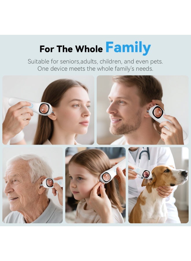MIAOYAN 1080P Digital Ear Otoscope with 1.38-Inch LCD Screen, 4 LED Lights, 3X Magnification, 2 Interchangeable Probes for Ear, Nose, Mouth, Dental and Skin Inspection - Image 2