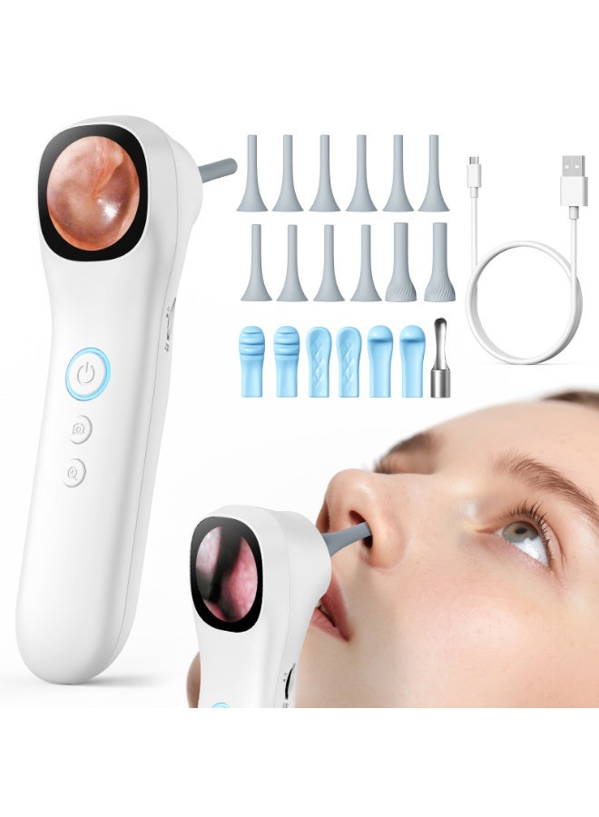 MIAOYAN 1080P Digital Ear Otoscope with 1.38-Inch LCD Screen, 4 LED Lights, 3X Magnification, 2 Interchangeable Probes for Ear, Nose, Mouth, Dental and Skin Inspection - Image 4