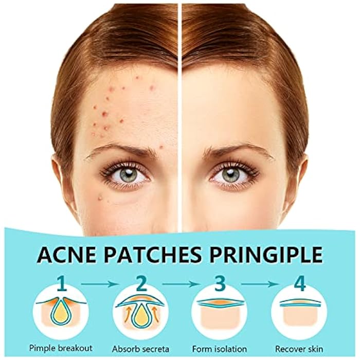 PICcircuit 180 Counts Pimple Patches for Face Hydrocolloid Acne Patches for face Invisible Zit Patches for Face Pimple Patch Acne Spot Treatment Patch Blemish Patches Cover Patches Stickers - Image 2