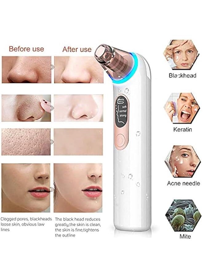MOXO Blackhead Remover Pore Vacuum   Electric Facial Suction Cleaner USB  Acne Comed Whitehead Extractor LED Display Upgraded Blue Light with 4 Replaceable Probes for Women Men  - Image 4