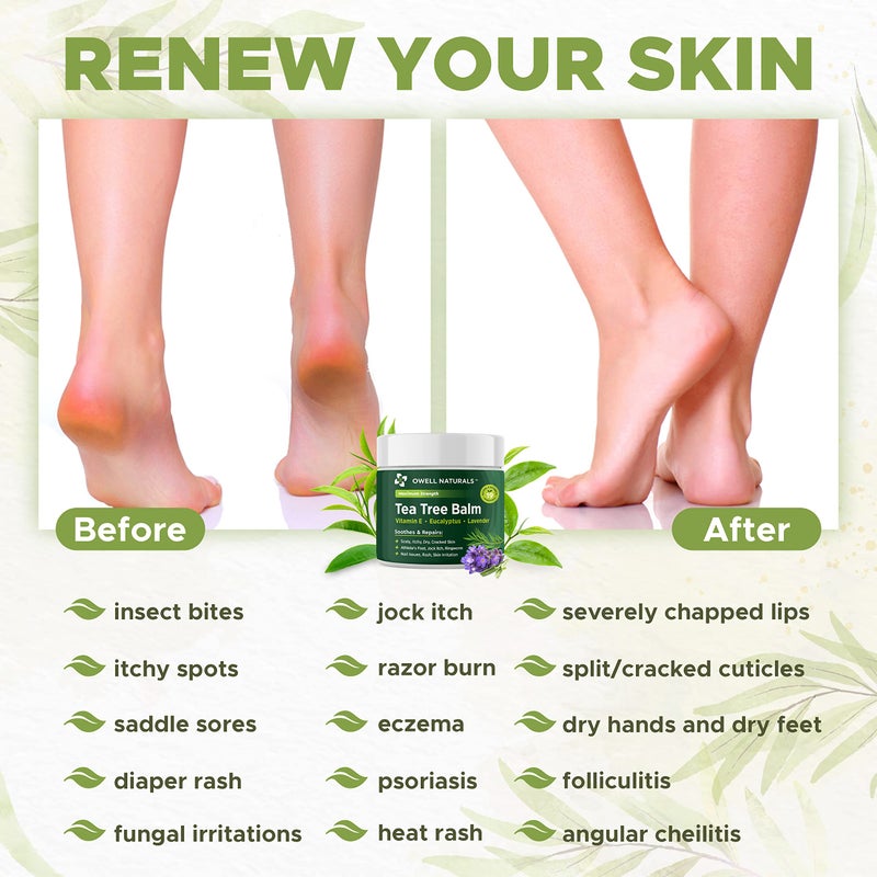 OWELL NATURALS Tea Tree Balm Oil 2 Fl Oz for Itchy, Dry and Cracked Skin, Rashes, Bee Stings, Splinters, Poison Ivy, Insect Bites, Cuts and Burns - Paraben-Free and Made in The USA (1 Pack) - Image 4