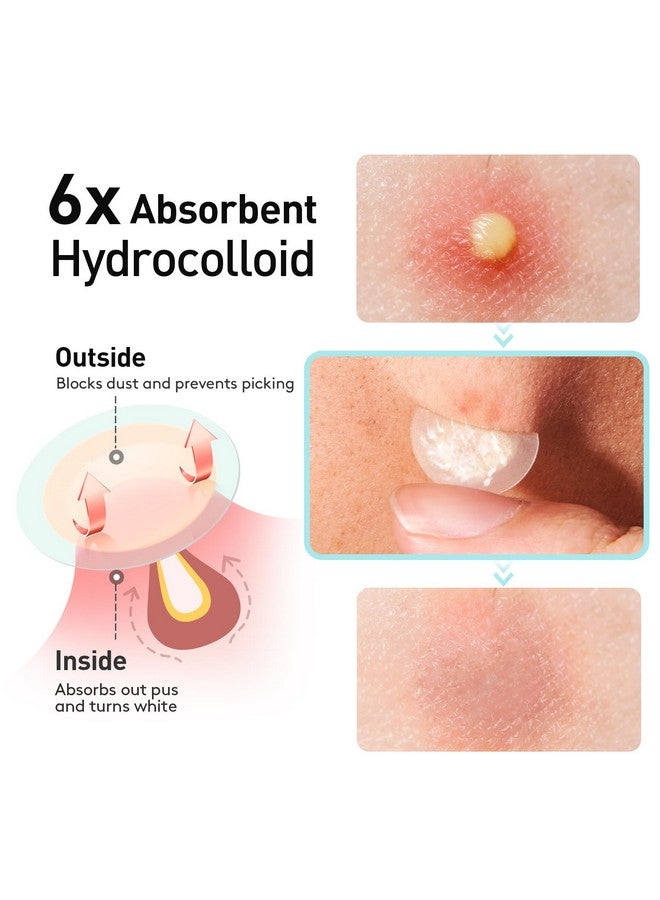 تي كيه تي كيه لصقات حب الشباب من تي كي تي كي، لصقات حب الشباب غير المرئية للوجه بسمك 12 مم مع حمض الساليسيليك، حافة خارجية رقيقة للغاية 0.01 سم، لصقة هيدروكولويد للبثور والرؤوس البيضاء وبقع حب الشباب الكيسية، 48 لصقة - Image 3