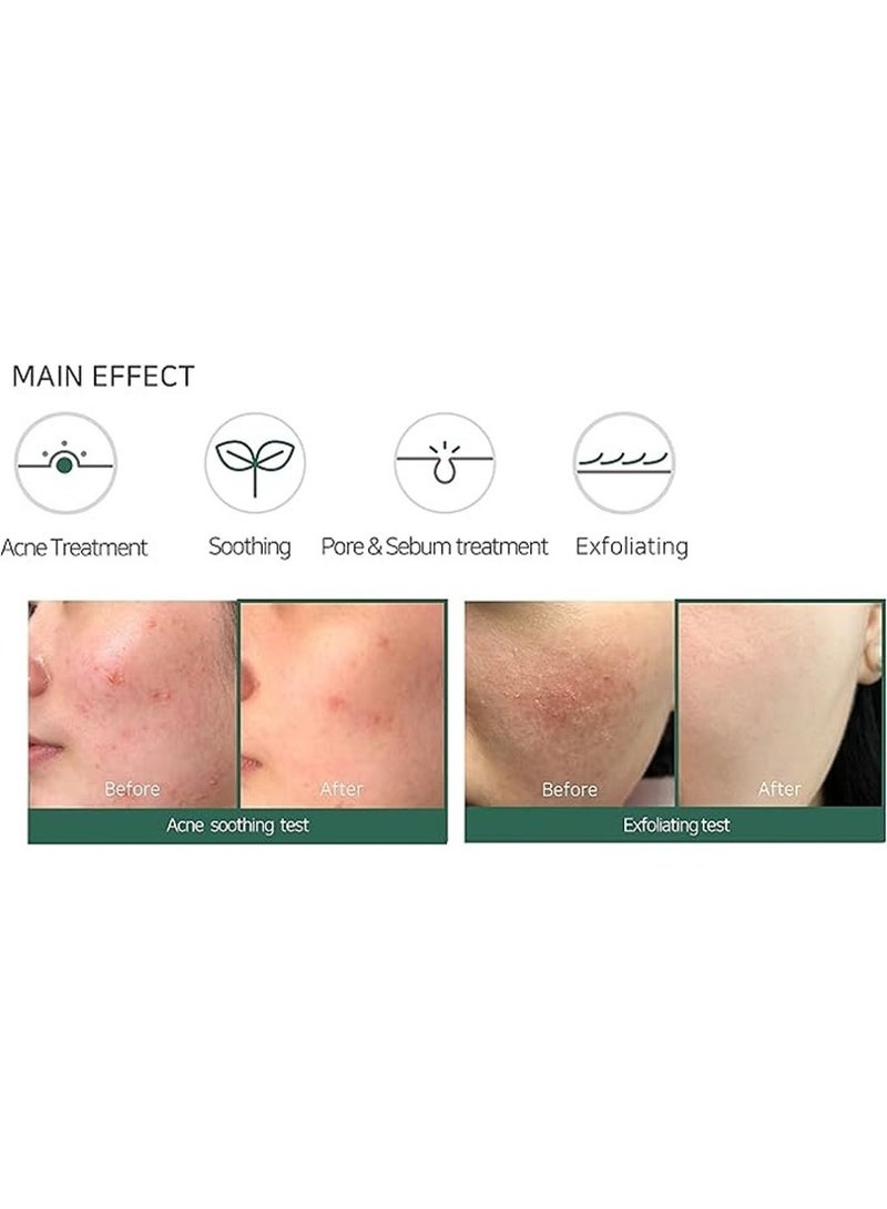 Some by Mi Aha Bha Pha 30 Days Miracle Acne Clear Foam - Made From Tea Tree Leaf Water For Acne Prone Skin - Daily Face Cleanser For Removing Sebum And Dead Cells 100ml - Image 5