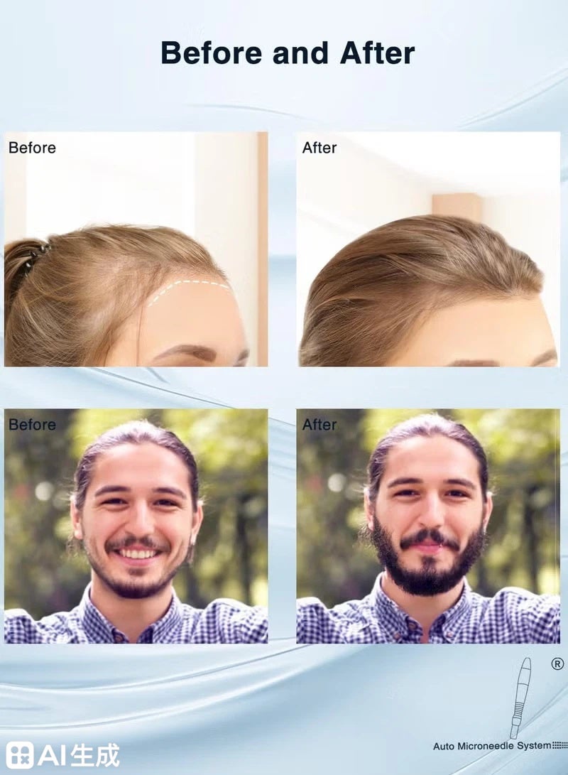 بيو نيدل ختم إبرة دقيقة قابل للتعديل، ختم إبرة دقيقة للبشرة والوجه والجسم، قلم إبرة دقيقة للشعر واللحية والوجه - Image 5