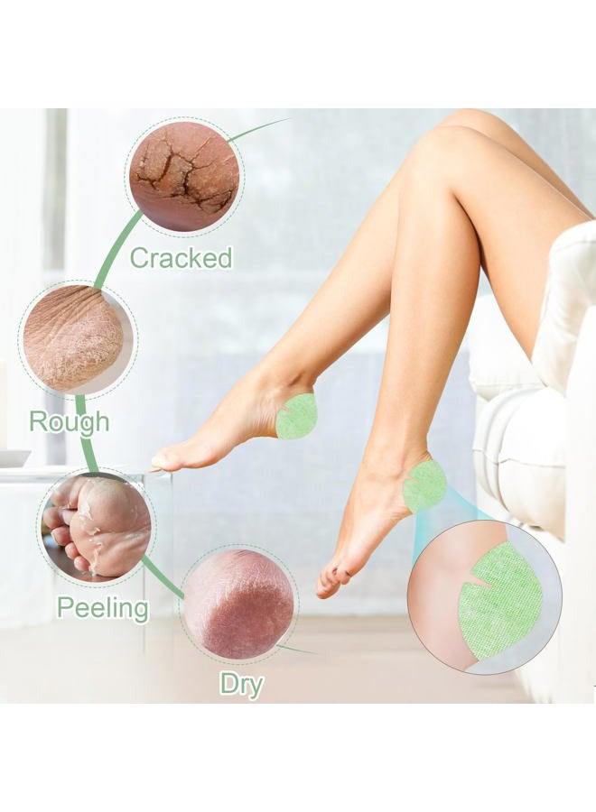 TEAWOO 30PCS Patented Aloe Vera Cracked Heel Treatment Patches, New Upgraded Cracked Heel Repair Bandage - Image 2