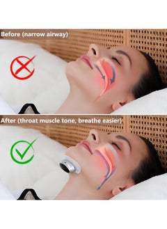General Anti Snoring Devices, Smart Anti Snoring Device with Adjustable 3 Modes, Snore Stopper with Ergonomic Design for Comfortable Wearing  - Image 3