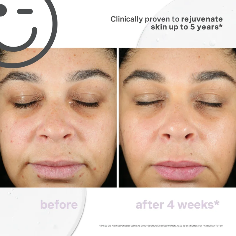 Kate Somerville Kateceuticals SuperCell Rejuvenation Serum 30ml