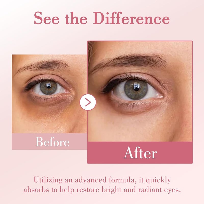 OneSpring Eye Cream Under Eye Cream with Caffeine Hyaluronic Acid Vitamin E for Puffiness Wrinkles Fine Lines Daily Cream for Moisturizing and Hydrating Skin Care for Face 105 Fl Oz - Image 3