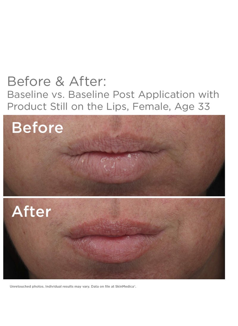 Skinmedica SkinMedica HA5 Smooth & Plump Lip System - Your Hydrating, Volumizing Lip Plumper for Visibly Fuller and Smoother Lips, 0.05 Oz  - Image 2