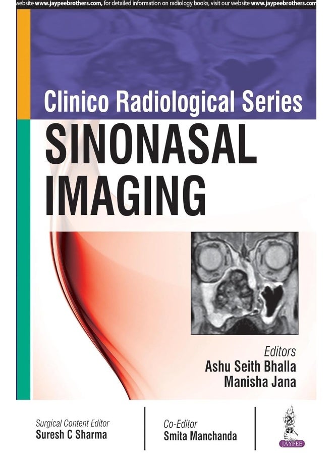 Clinico Radiological Series: Sinonasal Imaging 