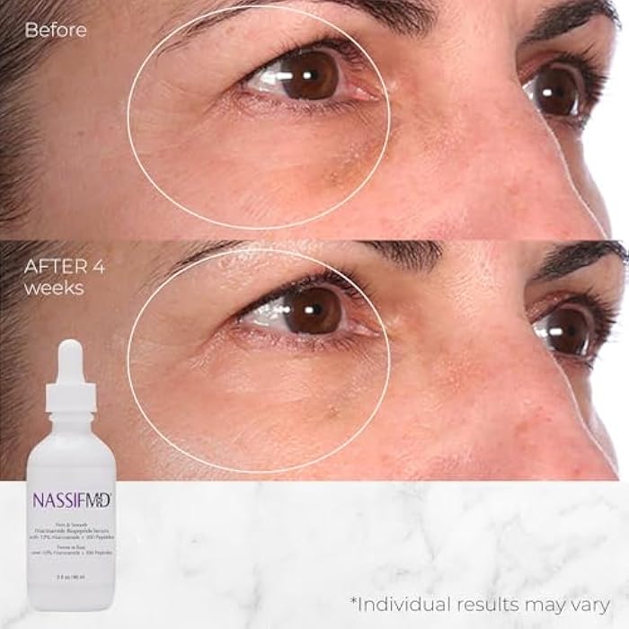 nassif md NassifMD Niacinamide Serum 10% with Cranberry Biopeptides and Ectoin, Brightening and Hydrating Vitamin B3 Face Serum, Evens Tone, Smooths Texture, Reduces Fine Lines, Boosts Radiance - Image 3