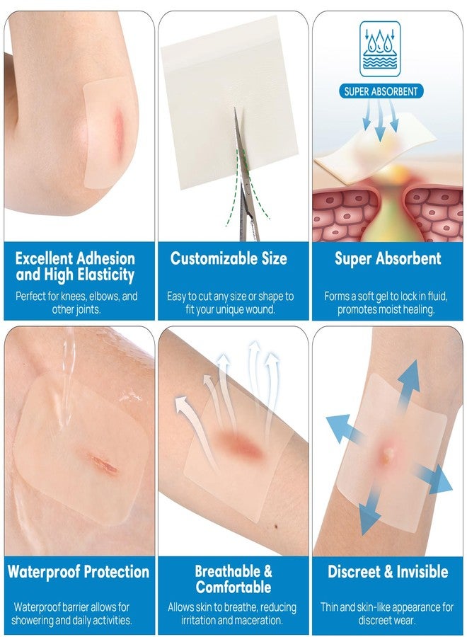OUJEALEE Hydrocolloid Roll, 2 Inch x 120 Inch, 2 Rolls, Cut-to-Size, Hydrocolloid Dressing for Wound Care - Image 2