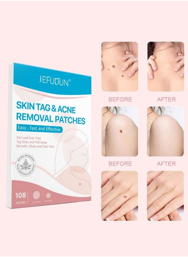 Sefudun Skin Tag and Acne Removal Patches Painless Easy to Use Effective Fast Transparent and Ultra-Thin Design Patches for Face and Body (108 Counts)  - Image 2