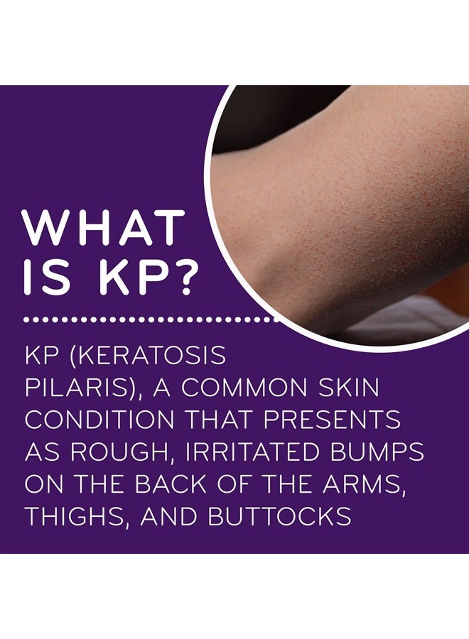 AmLactin كريم الترطيب Bumps Be Gone من KP، كريم مرطب للبشرة الجافة والخشنة، أنبوب 3 أونصة - Image 5