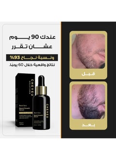 CHEVEU SOLUTIONS The Beard Growth Serum | 30-Day Supply with 5% AvenaPlex™ and Capilia Longa™  - Image 4