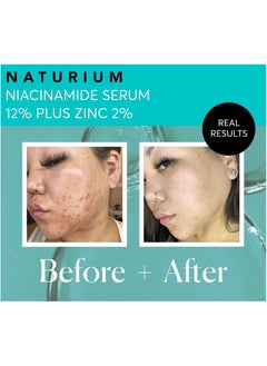 NATURIUM Niacinamide Face Serum 12% Plus Zinc 2%, Skin Complexion Treatment & Pore Minimizer, with Hyaluronic Acid & Vitamin E, 1 oz  - Image 3