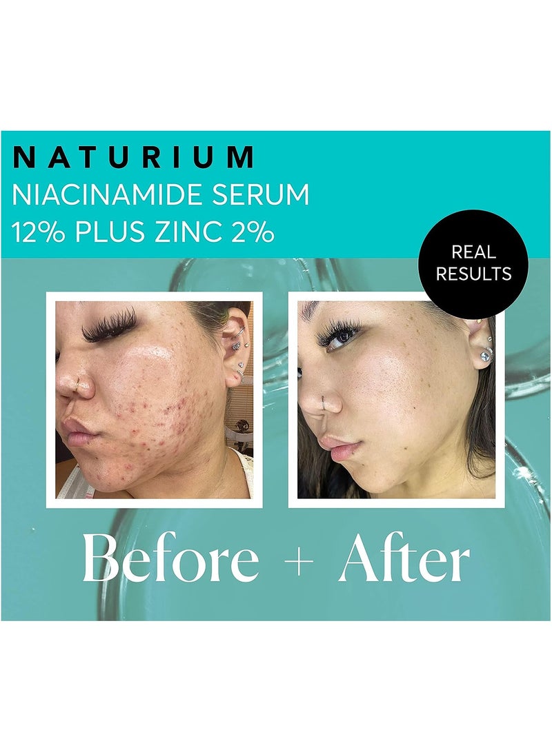 NATURIUM Niacinamide Face Serum 12% Plus Zinc 2%, Skin Complexion Treatment & Pore Minimizer, with Hyaluronic Acid & Vitamin E, 1 oz - Image 3