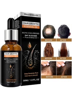 West&Month Hair Growth Essential Oil 30ML, Has The Effect Of Activating And Unblocking Pores, Repairing Hair Follicle Tubes, And Stimulating The Growth Of Dark Hair, Promotes Stronger, Healthier Hair  - Image 1