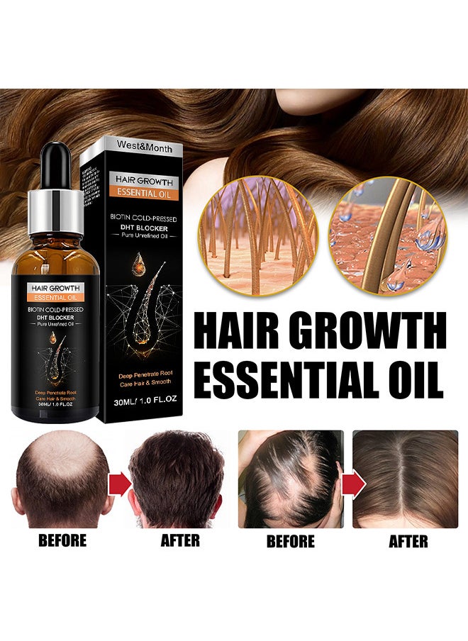 West&Month - Hair Growth Essential Oil 30ML, Has The Effect Of Activating And Unblocking Pores, Repairing Hair Follicle Tubes, And Stimulating The Growth Of Dark Hair, Promotes Stronger, Healthier Hair - Image 1