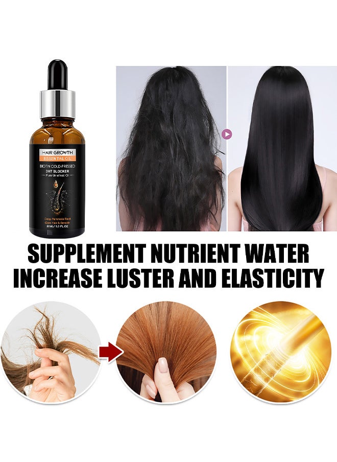 West&Month - Hair Growth Essential Oil 30ML, Has The Effect Of Activating And Unblocking Pores, Repairing Hair Follicle Tubes, And Stimulating The Growth Of Dark Hair, Promotes Stronger, Healthier Hair - Image 1