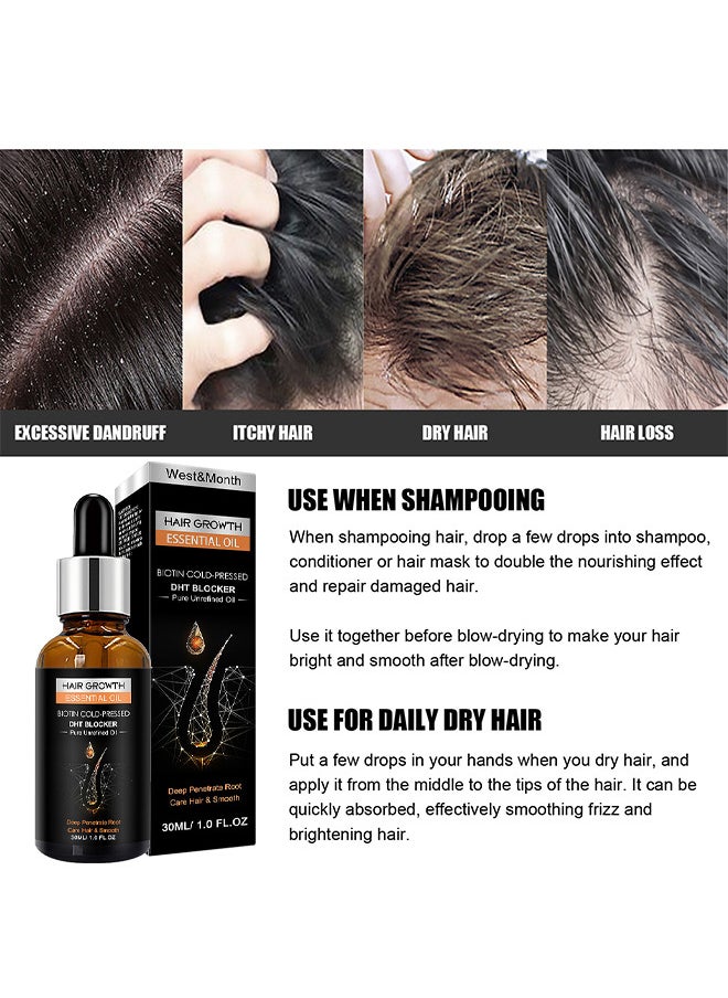 West&Month - Hair Growth Essential Oil 30ML, Has The Effect Of Activating And Unblocking Pores, Repairing Hair Follicle Tubes, And Stimulating The Growth Of Dark Hair, Promotes Stronger, Healthier Hair - Image 1