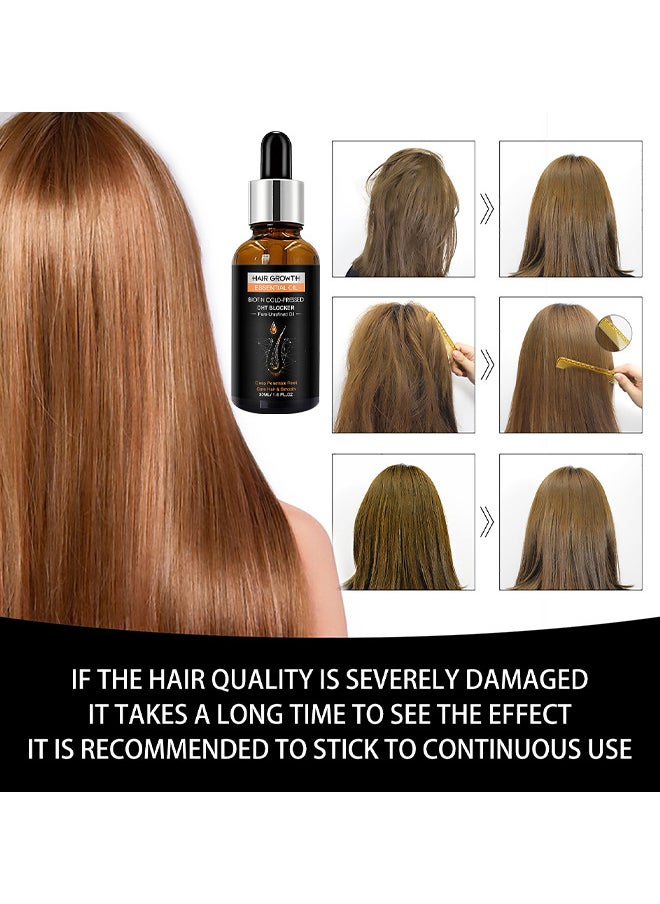 West&Month - Hair Growth Essential Oil 30ML, Has The Effect Of Activating And Unblocking Pores, Repairing Hair Follicle Tubes, And Stimulating The Growth Of Dark Hair, Promotes Stronger, Healthier Hair - Image 1
