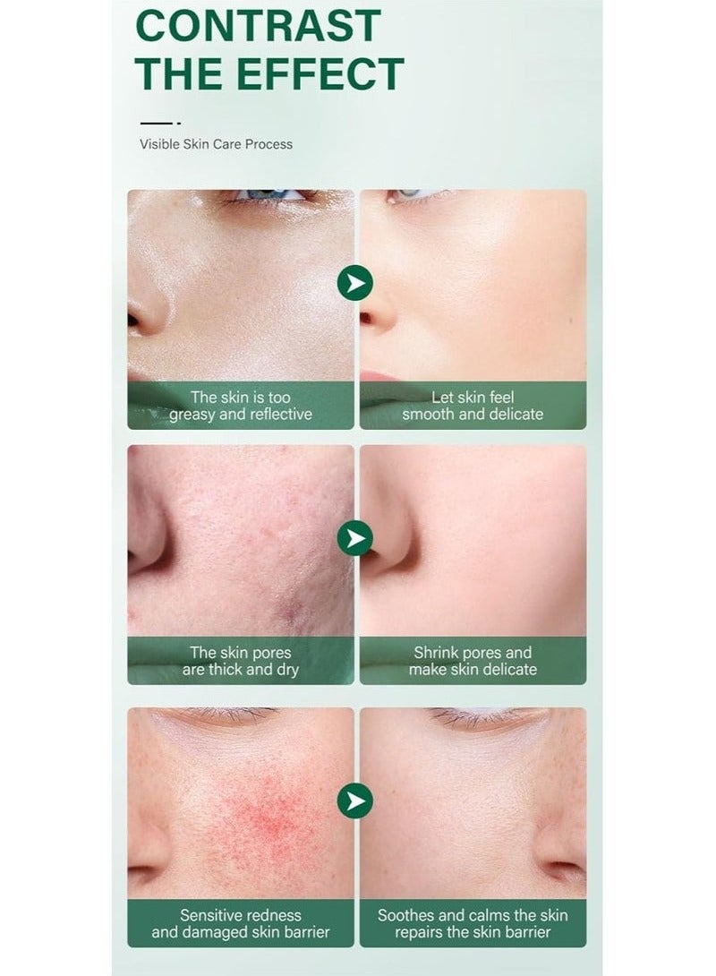 IREV Centella Cream, rich in VCCream, Moisturizing Cream, Anti-aging - Image 4