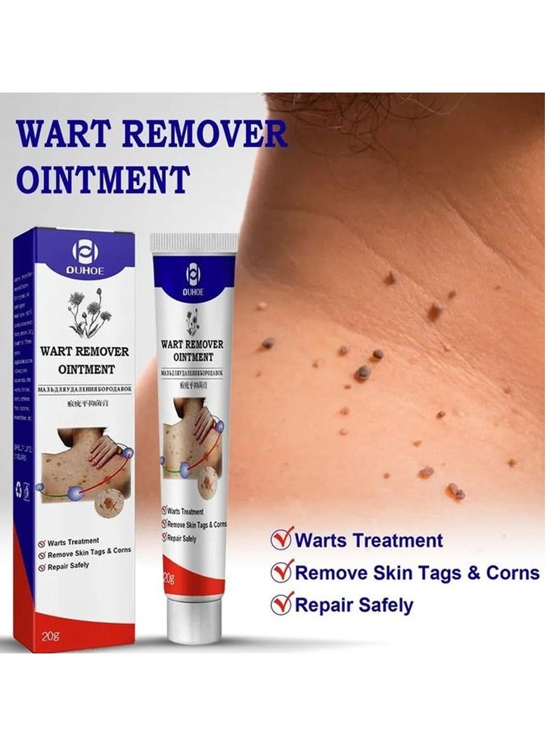 OUHOE Warts Remover Original Cream Herpes Condyloma Skin Tag Wart Removal Ointment Mole Removal Wart Cream Wart Removal Ointment Warts Skin Tags Remover - Image 2