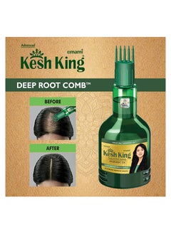 Kesh King Ayurvedic Scalp and Hair Oil, 100ml  - Image 5