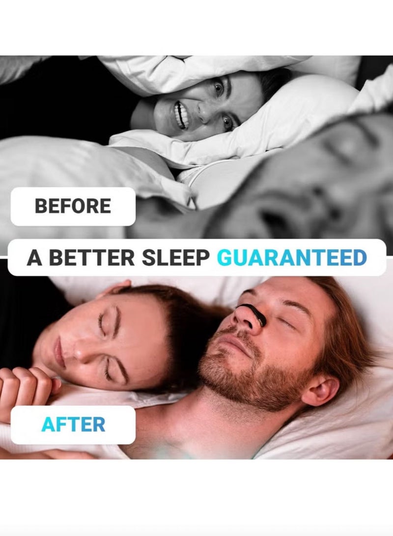 يوكا نوْم أفضل، شرائط الأنف المضادة للشخير، لاصقات أنف آمنة وفعّالة، تنفّس أفضل، شرائط الأنف لتحسين التنفّس، معدات مضادة للشخير للجنسين للاستخدام المنزلي (15 زوجًا من لاصقات الأنف، متوفرة باللون الأسود) - Image 2