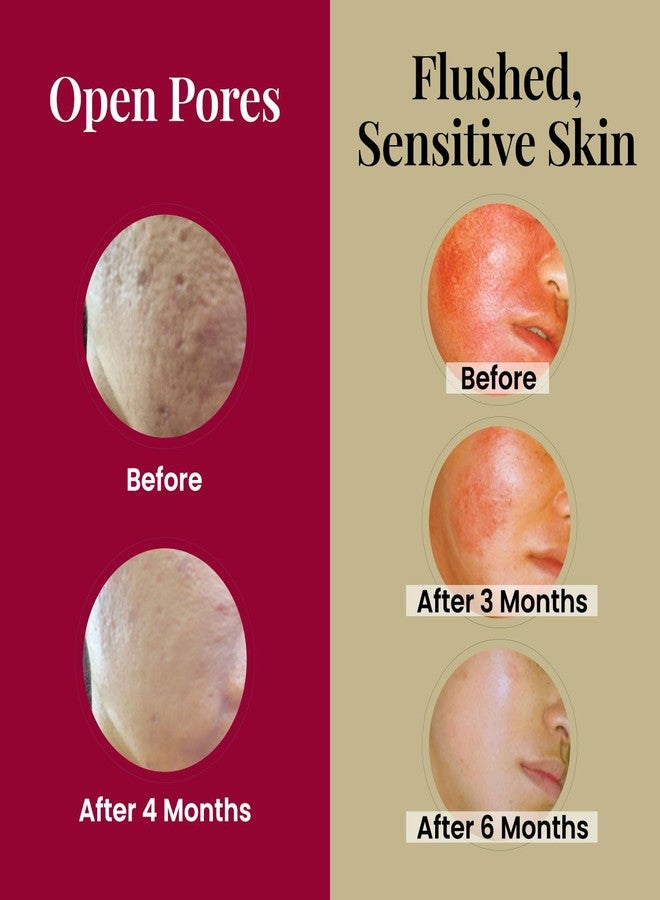 LABO Nutrition Le Revital 98% Concentrated Nano Placenta Extract, Umbilical & Sodium Hyaluronate, Anti-aging Serum from Japan, Skin Rejuvenate Essence, Reduce Wrinkles + Hydration, Non-greasy - Image 4