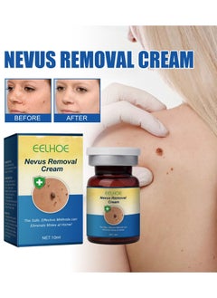 Nevus And Wart Removal Cream 10 Ml