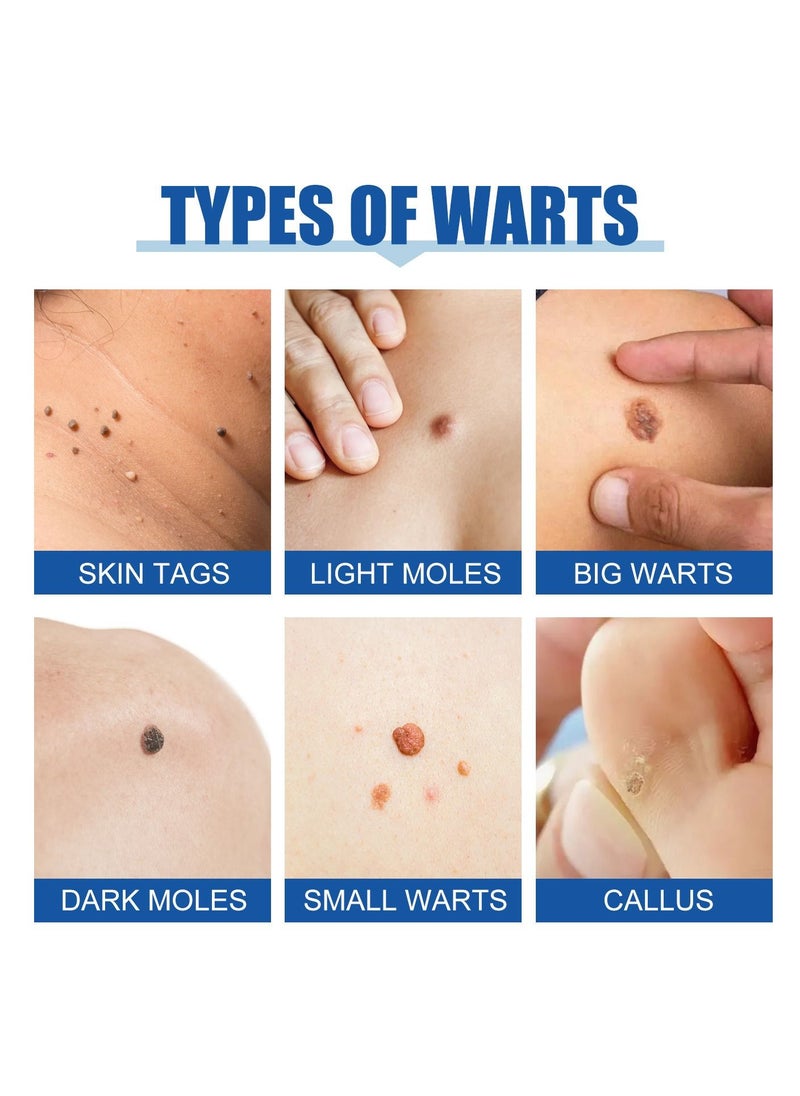EELHOE - Nevus And Wart Removal Cream 10 Ml - Image 1
