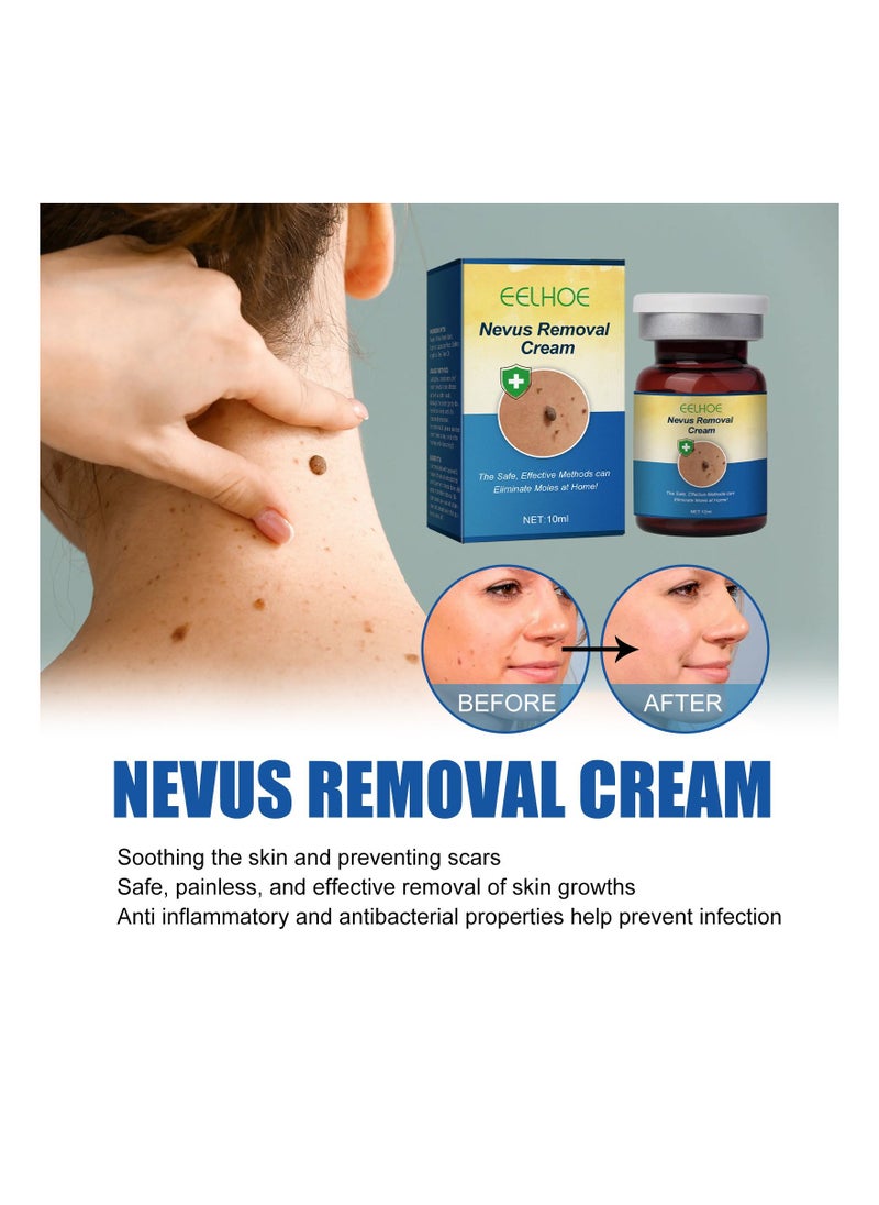 EELHOE - Nevus And Wart Removal Cream 10 Ml - Image 1