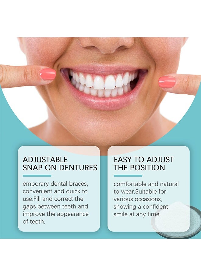 ORALHOE - Veneers False Teeth, Adjustable Snap-On Braces, Comfortable Temporary Dental Restoration Kit - Image 1