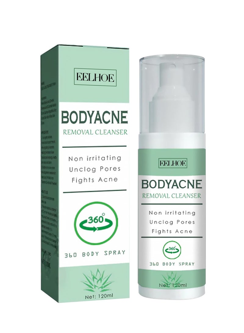 EELHOE Body Acne Cleansing Spray Deep Cleansing Back Arms Downplaying Acne Marks Beauty Moisturising Spray 120ML - Image 1
